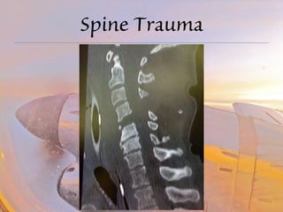 Spine Trauma 
 