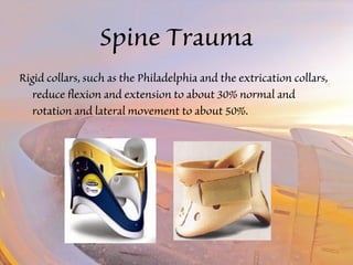 Spine Trauma 
Rigid collars, such as the Philadelphia and the extrication collars, 
reduce flexion and extension to about 30% normal and 
rotation and lateral movement to about 50%. 
 
