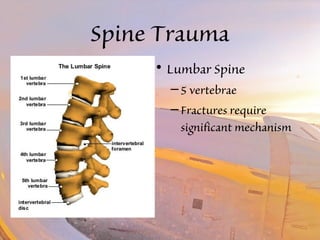 Spine Trauma 
• Lumbar Spine 
– 5 vertebrae 
– Fractures require 
significant mechanism 
 