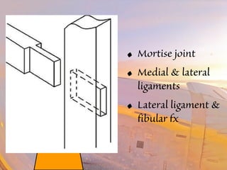 • Mortise joint 
• Medial & lateral 
ligaments 
• Lateral ligament & 
fibular fx 
 