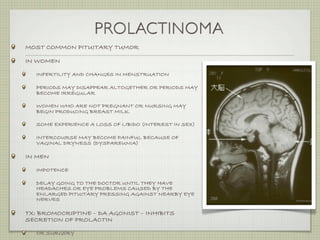 PROLACTINOMA
MOST COMMON PITUITARY TUMOR

IN WOMEN

   INFERTILITY AND CHANGES IN MENSTRUATION

   PERIODS MAY DISAPPEAR ALTOGETHER OR PERIODS MAY
   BECOME IRREGULAR

   WOMEN WHO ARE NOT PREGNANT OR NURSING MAY
   BEGIN PRODUCING BREAST MILK.

   SOME EXPERIENCE A LOSS OF LIBIDO (INTEREST IN SEX)

   INTERCOURSE MAY BECOME PAINFUL BECAUSE OF
   VAGINAL DRYNESS (DYSPAREUNIA)

IN MEN

   IMPOTENCE

   DELAY GOING TO THE DOCTOR UNTIL THEY HAVE
   HEADACHES OR EYE PROBLEMS CAUSED BY THE
   ENLARGED PITUITARY PRESSING AGAINST NEARBY EYE
   NERVES

TX: BROMOCRIPTINE – DA AGONIST – INHIBITS
SECRETION OF PROLACTIN

   OR SURGERY
 