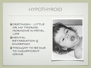 HYPOTHYROID


CRETINISM – LITTLE
OR NO THYROID
HORMONE IN FETAL
LIFE
MENTAL
RETARDATION &
DWARFISM
THOUGHT TO BE DUE
TO INSUFFICIENT
IODINE
 