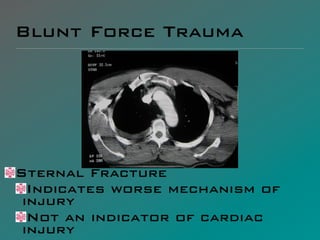 Blunt Force Trauma




Sternal Fracture
  Indicates worse mechanism of
 injury
  Not an indicator of cardiac
 injury
 