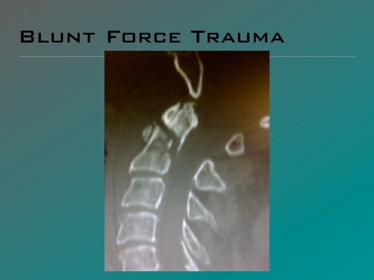 FCA 0111 Blunt Force Trauma