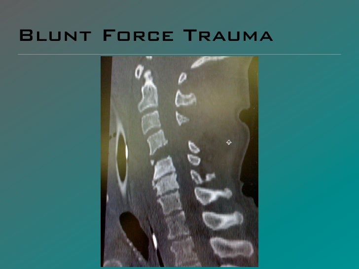 blunt force trauma