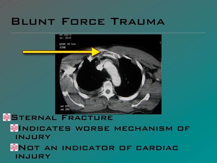 blunt force trauma blunt force trauma