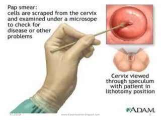 9/12/201411
www.drjayeshpatidar.blogspot.com