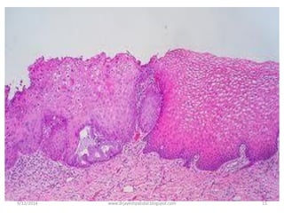 9/12/2014
15
www.drjayeshpatidar.blogspot.com