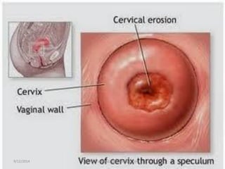 9/12/201416www.drjayeshpatidar.blogspot.com