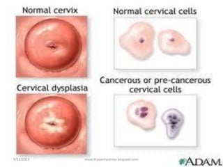 9/12/2014
17
www.drjayeshpatidar.blogspot.com