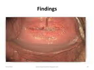 Findings
9/12/2014
24
www.drjayeshpatidar.blogspot.com