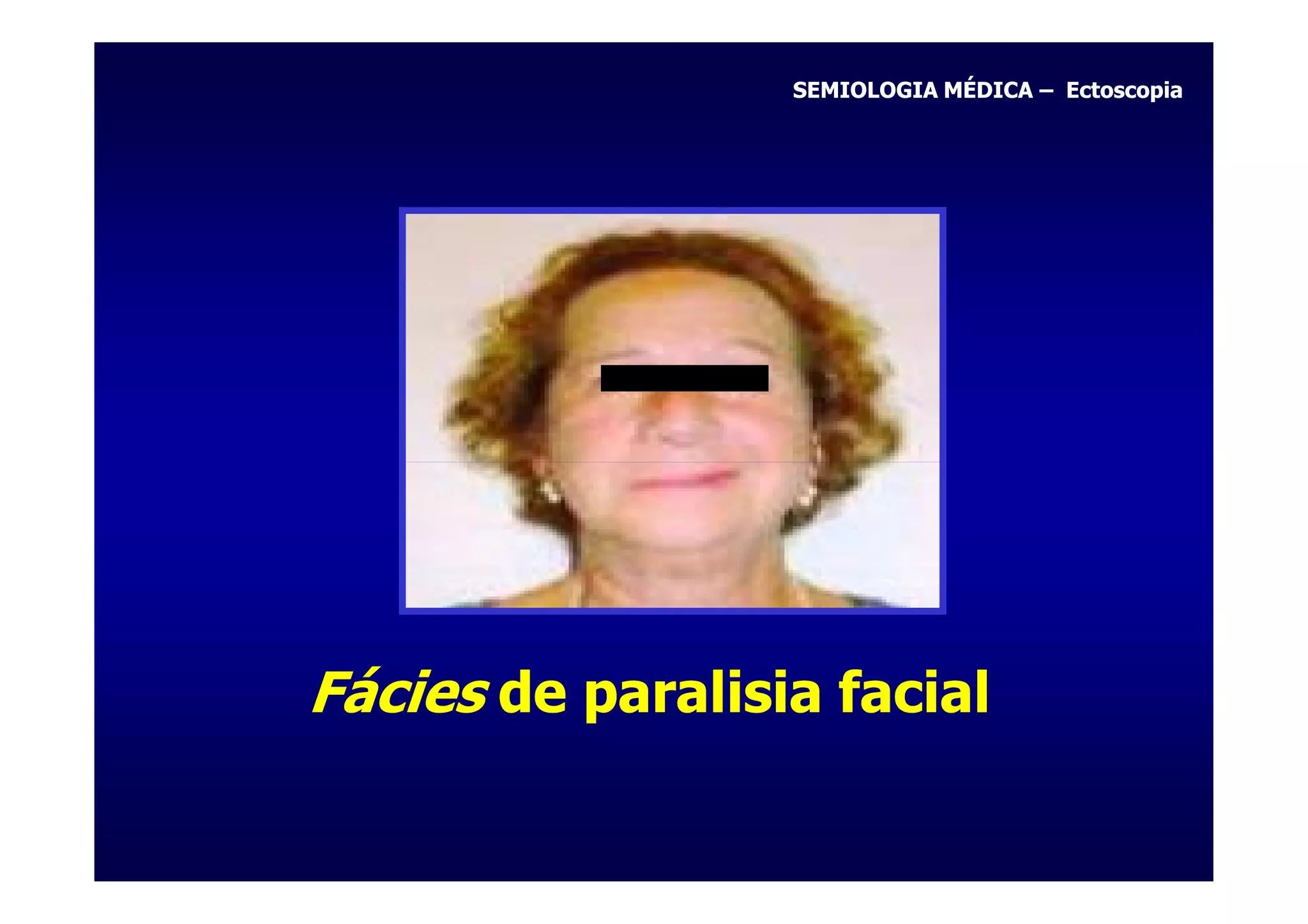 Fácies - Profa. Rilva Muñoz | PPT