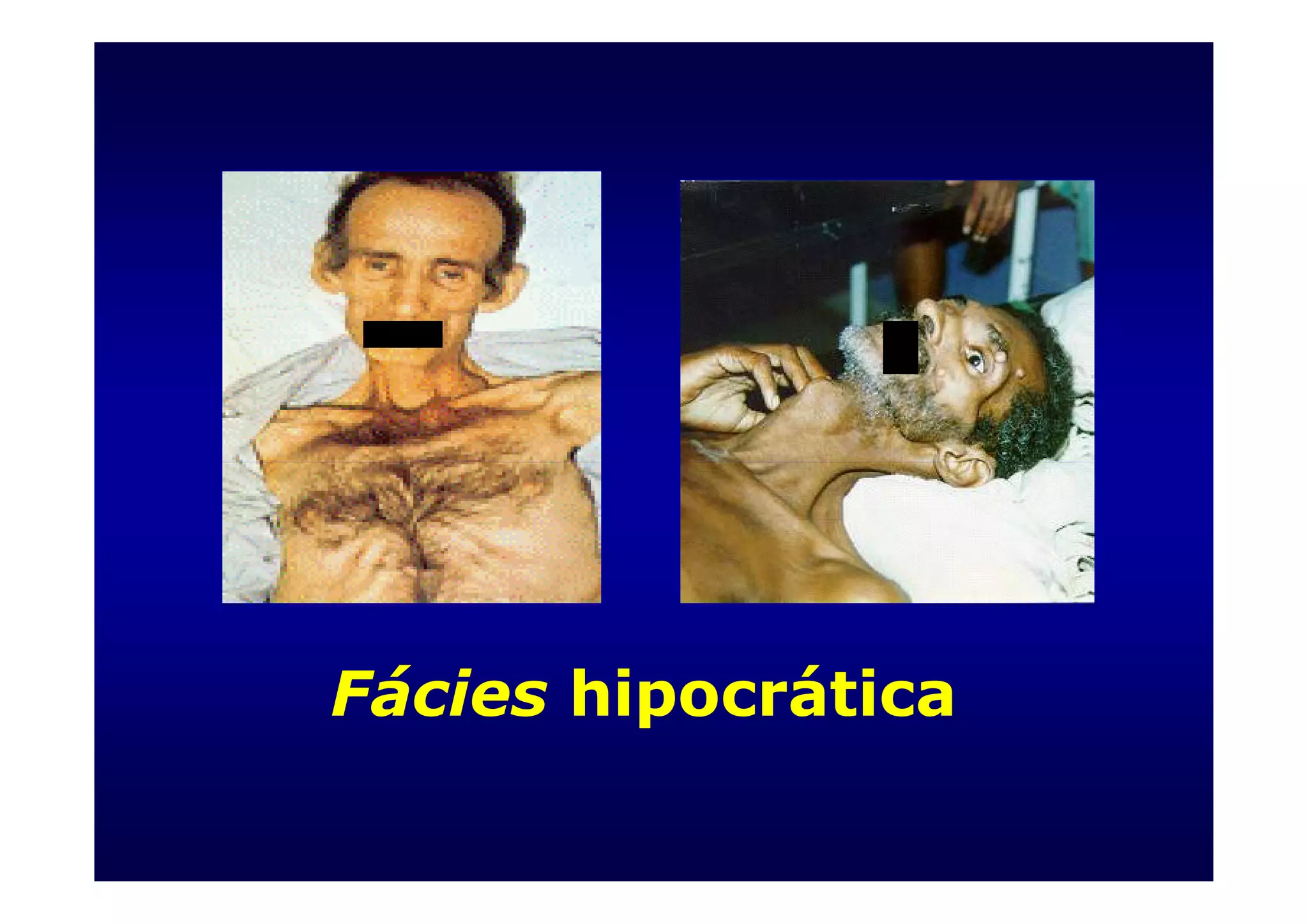 Fácies - Profa. Rilva Muñoz | PPT