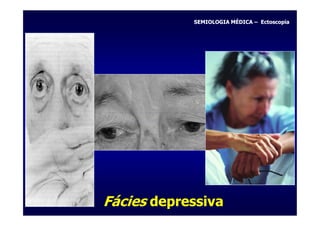 SEMIOLOGIA MÉDICA – Ectoscopia




Fácies depressiva
 