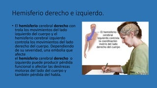Hemisferio derecho e izquierdo.
• El hemisferio cerebral derecho con
trola los movimientos del lado
izquierdo del cuerpo y el
hemisferio cerebral izquierdo
controla los movimientos del lado
derecho del cuerpo. Dependiendo
de su severidad, una embolia que
afecte
el hemisferio cerebral derecho o
izquierdo puede producir pérdida
funcional o afectar las destrezas
motoras del lado del cuerpo y
también pérdida del habla.
 