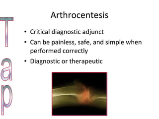 Arthrocentesis Critical diagnostic adjunct  Can be painless, safe, and simple when performed correctly Diagnostic or therapeutic Tap 