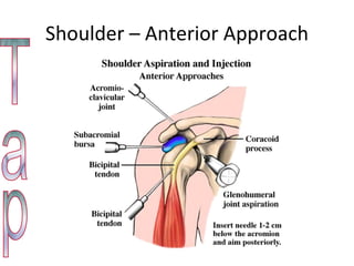 Shoulder – Anterior Approach Tap 