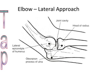 Elbow – Lateral Approach Tap 