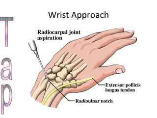 Wrist Approach Tap 