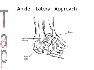 Ankle – Lateral  Approach Tap 