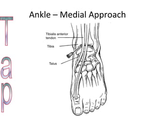 Ankle – Medial Approach Tap 