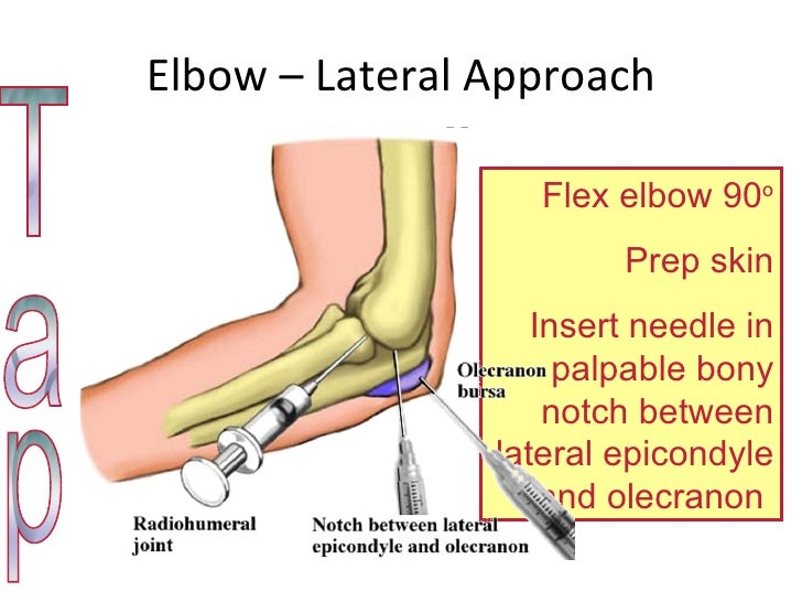 clinical seriesarthitis