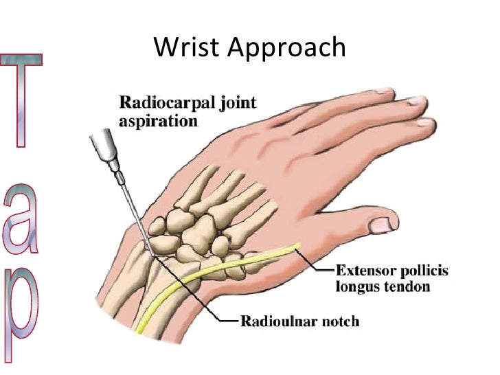 clinical seriesarthitis