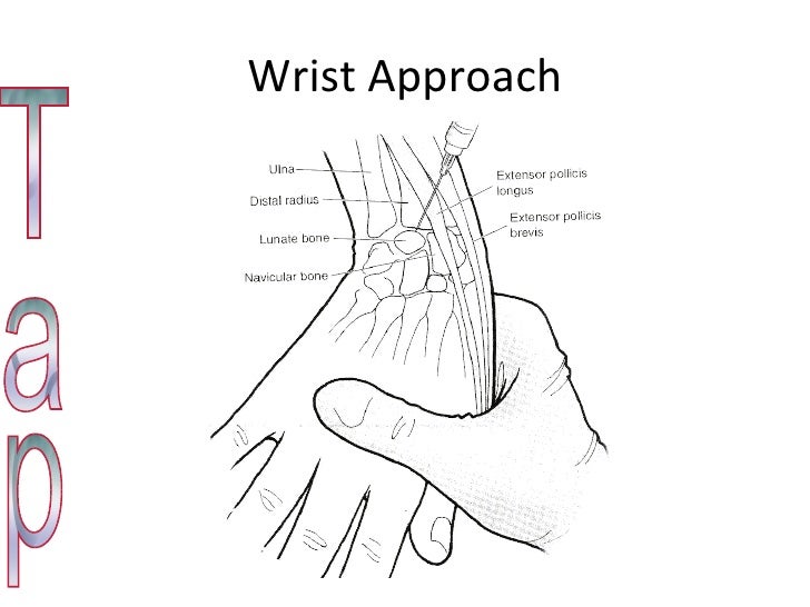 clinical seriesarthitis