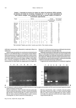 102                                                                   Shana L. Garmatz et al.



                     Quadro 7. Resultado da técnica de reação em cadeia de polimerase (PCR) realizada
                    em amostras de tecido de 16 bovinos. Os bovinos de 1 a 11 são casos espontâneos de
                      febre catarral maligna. Cinco bovinos (E1-E5) são os animais usados no estudo de
                                                  transmissão experimental
                      Órgão                                     Bovino                               Tecidos      Porcentagem
                                                                                                positivos/tecidos de positivos
                                    1   2   3   4   5   6   7     8      9 10 11 E1 E2 E3 E4 E5   examinados
                     Abomaso        oa o    o   o   o   o o -b          o o      o   o o o       o   o       0/1             0
                     Adrenal        o o     o   o   o   o o +c          o o      -   o o o       o   o       1/2             50
                     Baço           o o     o   o   -   o + o           o -      o   o o o       -   -       1/5             20
                     Bexiga         o o     o   o   o   o -  -          + o      -   o o -       o   o       1/5             20
                     Bochecha       o o     o   o   o   o o -           o o      o   o o o       o   o       0/1             0
                     Cornetos       o o     o   -   o   o o o           o o      o   + + -       o   o       2/4             50
                     Encéfalo       o +     -   o   -   o o o           - +      o   + o +       o   o       4/7             57
                     Fígado          - o    o   o   o   o o -           - +      -   + o -       -   -       2/9             22
                     Focinho        o o     o   o   o   o o o           - o      -   o o o       o   o       0/2             0
                     Int. delgado   o o     o   -   o   - o o           o o      -   o o -       o   o       0/4             0
                     Int. grosso    o o     o   o   -   o o o           o o      o   o o o       o   o       0/1             0
                     Língua         o o     o   o   o   o o o           o o      o   o o o       -   o       0/1             0
                     Linfonodo      o o     -   o   -   + o +           o o      -   o o o       o   -       26              33
                     Rete mirabd    o -     -   -   o   - o o           - o      o   o + -       -   o       1/8            12,5
                     Rim             - o    -   +   -   + o -           o -      -   + + -       o   -       4/12            33
                     Rúmen          o o     o   o   o   o o o           o o      o   o o o       -   o       0/1             0
                     Tonsila        o o     o   o   -   o o o           o o      o   o o o       -   o       0/2             0

                    aNão   examinado, bnegativo para OvHV-2, cpositivo para OvHV-2, dRete mirabile carotídea.



infiltrado mononuclear inflamatório moderado difuso na                               Bovinos E1 e E5. No intestino havia leve infiltrado intersticial e
submucosa.                                                                           vasculite na submucosa e muscular (Bov. E2).
    Havia erosão do epitélio de revestimento da bochecha do                              Infiltrado mononuclear foi observado no interstício da tireóide
Bovino E1 com infiltrado difuso e acentuado de células inflama-                      (Bov. E1). Na bexiga do Bovino E2 havia ulceração multifocal do
tórias mononucleares na submucosa superficial. Lesões erosivo-                       epitélio de transição com infiltrado mononuclear na lâmina pró-
ulcerativas associadas a infiltrado mononuclear da submucosa                         pria subjacente; infiltrado mínimo de células mononucleares ocor-
eram observadas na mucosa oral e língua, esôfago e rúmen (Bov.                       ria na parede dos vasos da lâmina própria e submucosa associado
E4) e mucosa esofagiana do Bovino E3. Leve infiltrado                                a edema na muscular da mucosa e submucosa.
mononuclear foi observado nos espaços-porta do fígado dos                                Fragmentos de tonsila do Bovino E4 resultaram negativos




A                                                                                                                                                     B
Fig. 10. Reação em cadeia de polimerase (PCR). Eletroforese em gel de agarose dos produtos da PCR nested mostrando fragmentos amplifi-
    cados de 228 pares de bases (pb).
    (A) Casos espontâneos. Linha 1: tamanho molecular padrão (pb).        (B) Casos experimentais. Linha 1: tamanho molecular padrão
    Linha 2: amostra de adrenal (Bov. 8). Linha 3: amostra de linfonodo   (pb). Linha 2: amostra de rim (Bov. E1). Linha 3: amostra de fígado
    (Bov. 8) Linha 4: amostra de baço (Bov. 7). Linha 5: amostra de rim   (Bov. E1). Linha 4: amostra de fígado (Bov. E5). Linha 5: amostra
    (Bov. 6). Linha 6: amostra de linfonodo (Bov. 6). Linha 7: amostra    de rim (Bov. E2). Linhas 6-8: amostras de rúmen, fígado e tonsila,
    de bexiga (Bov. 9). Linha 8: amostra de cerebelo (Bov. 2).            respectivamente (Bov. E4).

Pesq. Vet. Bras. 24(2):93-106, abr./jun. 2004
 