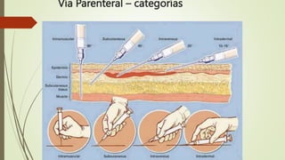 Vía Parenteral – categorías
 