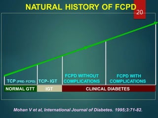 FCPD WITHO
NATURAL HISTORY OF FCPD
Mohan V et al, International Journal of Diabetes. 1995;3:71-82.
UT FCPD WITH
TCP (PRE- FCPD) TCP- IGT COMPLICATIONS COMPLICATIONS
NORMAL GTT IGT CLINICAL DIABETES
20
 