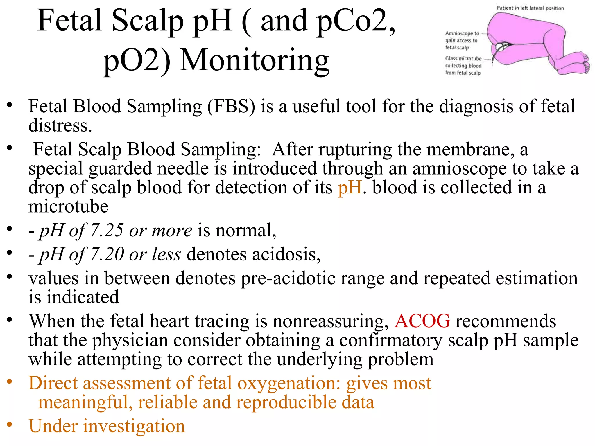 Fetal distress | PPS