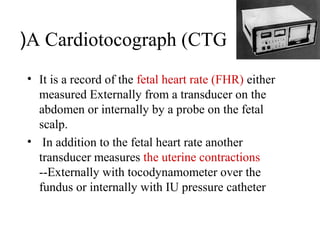 Fetal distress | PPS