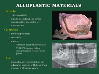 swelling_of_jaw_and_surgery_of_mandible_my_ppt.pptx