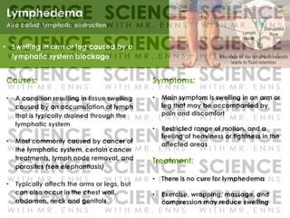 Symptoms:
• Main symptom is swelling in an arm or
leg that may be accompanied by
pain and discomfort
• Restricted range of motion, and a
feeling of heaviness or tightness in the
affected areas
Treatment:
• There is no cure for lymphedema
• Exercise, wrapping, massage, and
compression may reduce swelling
Lymphedema
Causes:
• A condition resulting in tissue swelling
caused by an accumulation of lymph
that is typically drained through the
lymphatic system
• Most commonly caused by cancer of
the lymphatic system, certain cancer
treatments, lymph node removal, and
parasites (see elephantiasis)
• Typically affects the arms or legs, but
can also occur in the chest wall,
abdomen, neck and genitals
• Swelling in arm or leg caused by a
lymphatic system blockage
 