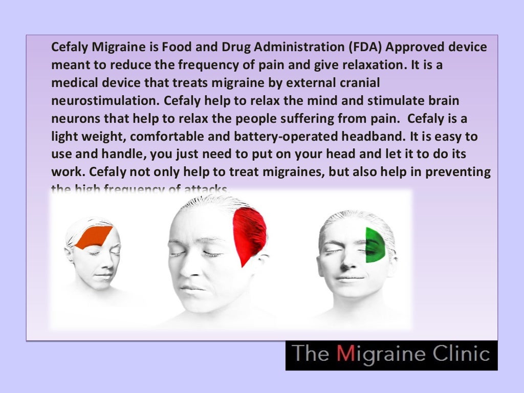 FDA Approved CEFALY Migraine Device An Effective And Safe Way To Get
