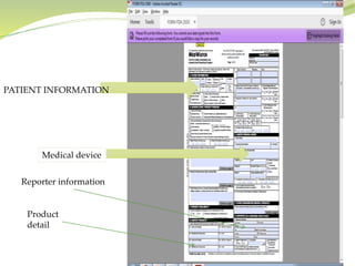 PATIENT INFORMATION
Medical device
Product
detail
Reporter information
 