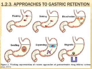 1.2.3. APPROACHES TO GASTRIC RETENTION
 