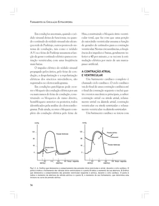 56
FUNDAMENTOS DA CIRCULAÇÃO EXTRACORPÓREA
Em condições anormais, quando o nó-
dulo sinusal deixa de funcionar, ou quan-
dooestímulodonódulosinusalnãoalcan-
ça a rede de Purkinje, outros pontos do sis-
tema de condução, tais como o nódulo
A-VouofeixedePurkinjeassumemafun-
çãodegeraroestímuloelétricoparaacon-
tração ventricular, com uma freqüência
mais baixa.
O impulso elétrico do nódulo sinusal
propagado pelos átrios, pelo feixe de con-
dução, a despolarização e a repolarização
elétricas dos sincícios miocárdicos, são
registrados no eletrocardiograma.
Em condições patológicas pode ocor-
rer o bloqueio da condução elétrica por um
ou mais ramos do feixe de condução, cons-
tituindo os bloqueios de ramo direito,
hemibloqueio anterior ou posterior, todos
identificados pela análise do eletrocardio-
grama. Pode ainda, ocorrer o bloqueio com-
pleto da condução elétrica pelo feixe de
Hiss, constituindo o bloqueio átrio-ventri-
cular total, que faz com que uma porção
do miocárdio ventricular assuma a função
de gerador de estímulos para a contração
ventricular. Nestas circunstâncias, a freqü-
ência dos impulsos é baixa, geralmente in-
ferior a 40 por minuto, e se recorre à esti-
mulação elétrica por meio de um marca-
passo artificial.
A CONTRAÇÃO ATRIAL
E VENTRICULAR
Um batimento cardíaco completo é
chamado ciclo cardíaco. O ciclo cardíaco
vai do final de uma contração cardíaca até
o final da contração seguinte e inclui qua-
tro eventos mecânicos principais, a saber:
contração atrial ou sístole atrial, relaxa-
mento atrial ou diástole atrial, contração
ventricular ou sístole ventricular e relaxa-
mento ventricular ou diástole ventricular.
Um batimento cardíaco se inicia com
Fig.3.3. A. Gráfico que demonstra o comportamento das pressões intra-ventricular e atrial, durante o ciclo cardíaco. O
ponto A indica o fechamento das válvulas átrio-ventriculares e o ponto B indica o momento da sua abertura. B.Gráfico
que demonstra o comportamento das pressões ventricular esquerda e aórtica, durante o ciclo cardíaco. O ponto A
indica o momento da abertura da válvula aórtica e o ponto B, o momento do seu fechamento, que determina uma
incisura na curva da pressão aórtica.
 