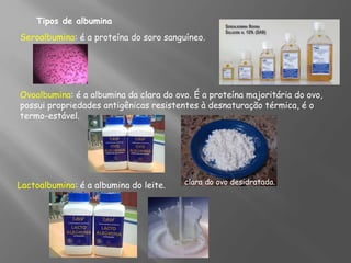 Tipos de albumina
Seroalbumina: é a proteína do soro sanguíneo.
Ovoalbumina: é a albumina da clara do ovo. É a proteína majoritária do ovo,
possui propriedades antigênicas resistentes à desnaturação térmica, é o
termo-estável.
Lactoalbumina: é a albumina do leite. clara do ovo desidratada.
 