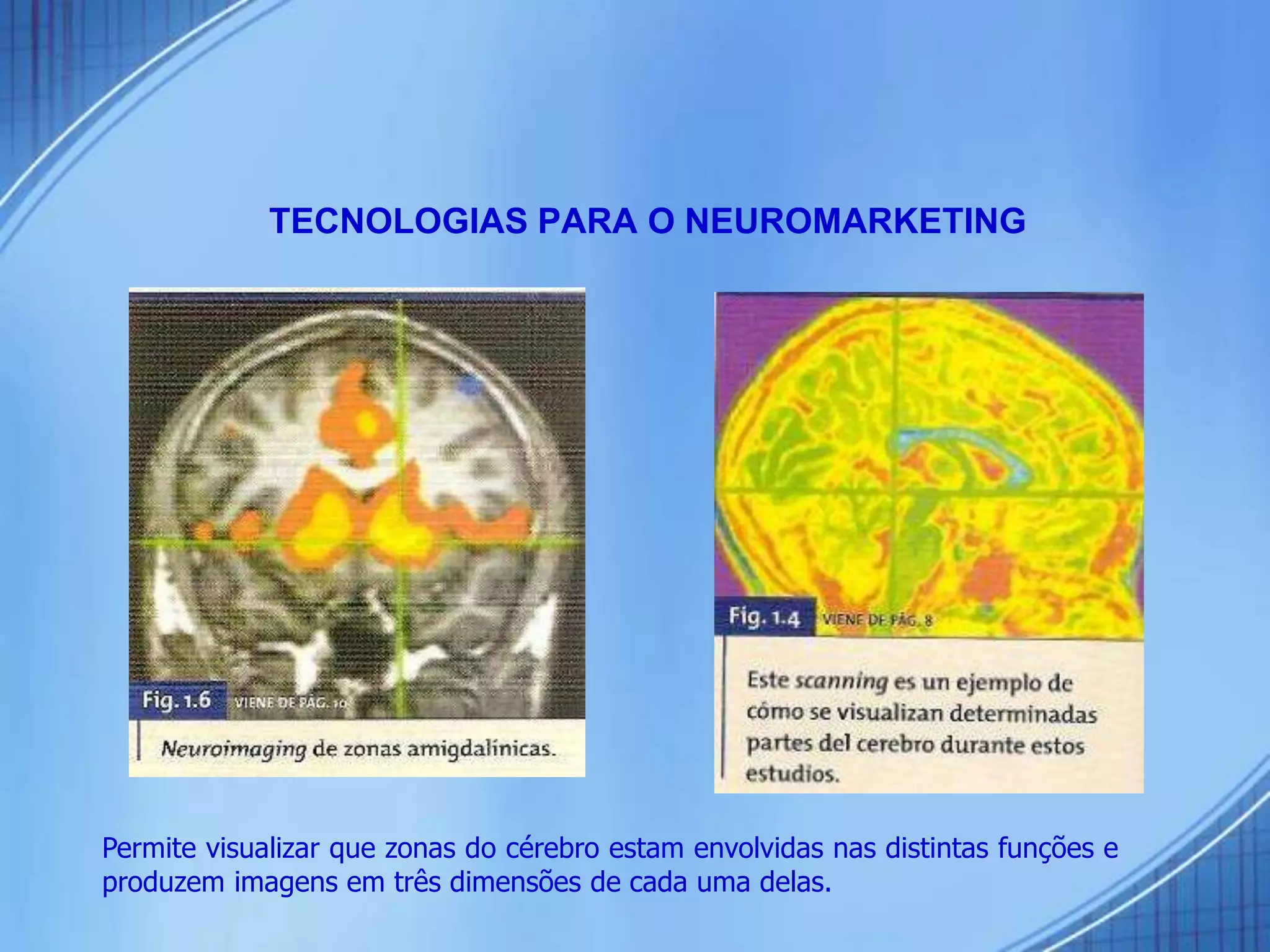 TECNOLOGIAS PARA O NEUROMARKETING
Permite visualizar que zonas do cérebro estam envolvidas nas distintas funções e
produzem imagens em três dimensões de cada uma delas.
 