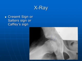 X-Ray
 Cresent Sign or
Salters sign or
Caffey’s sign
 