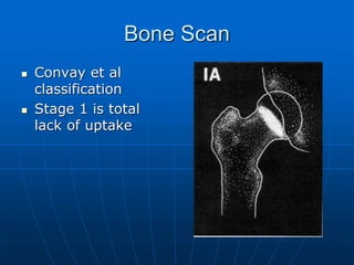 Bone Scan
 Convay et al
classification
 Stage 1 is total
lack of uptake
 