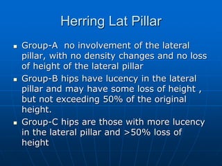 Herring Lat Pillar
 Group-A no involvement of the lateral
pillar, with no density changes and no loss
of height of the lateral pillar
 Group-B hips have lucency in the lateral
pillar and may have some loss of height ,
but not exceeding 50% of the original
height.
 Group-C hips are those with more lucency
in the lateral pillar and >50% loss of
height
 