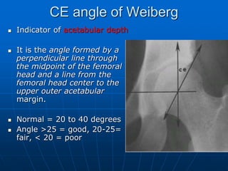 CE angle of Weiberg
 Indicator of acetabular depth
 It is the angle formed by a
perpendicular line through
the midpoint of the femoral
head and a line from the
femoral head center to the
upper outer acetabular
margin.
 Normal = 20 to 40 degrees
 Angle >25 = good, 20-25=
fair, < 20 = poor
 