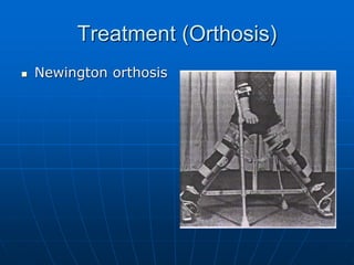 Treatment (Orthosis)
 Newington orthosis
 