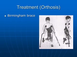 Treatment (Orthosis)
 Birmingham brace
 