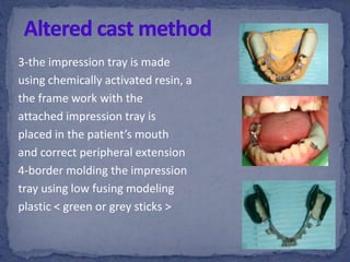 3-the impression tray is made
using chemically activated resin, a
the frame work with the
attached impression tray is
placed in the patient’s mouth
and correct peripheral extension
4-border molding the impression
tray using low fusing modeling
plastic < green or grey sticks >
 
