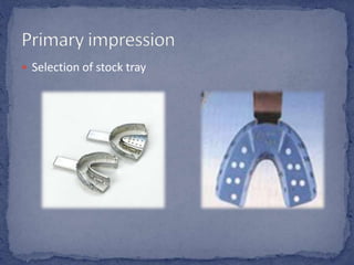  Selection of stock tray
 