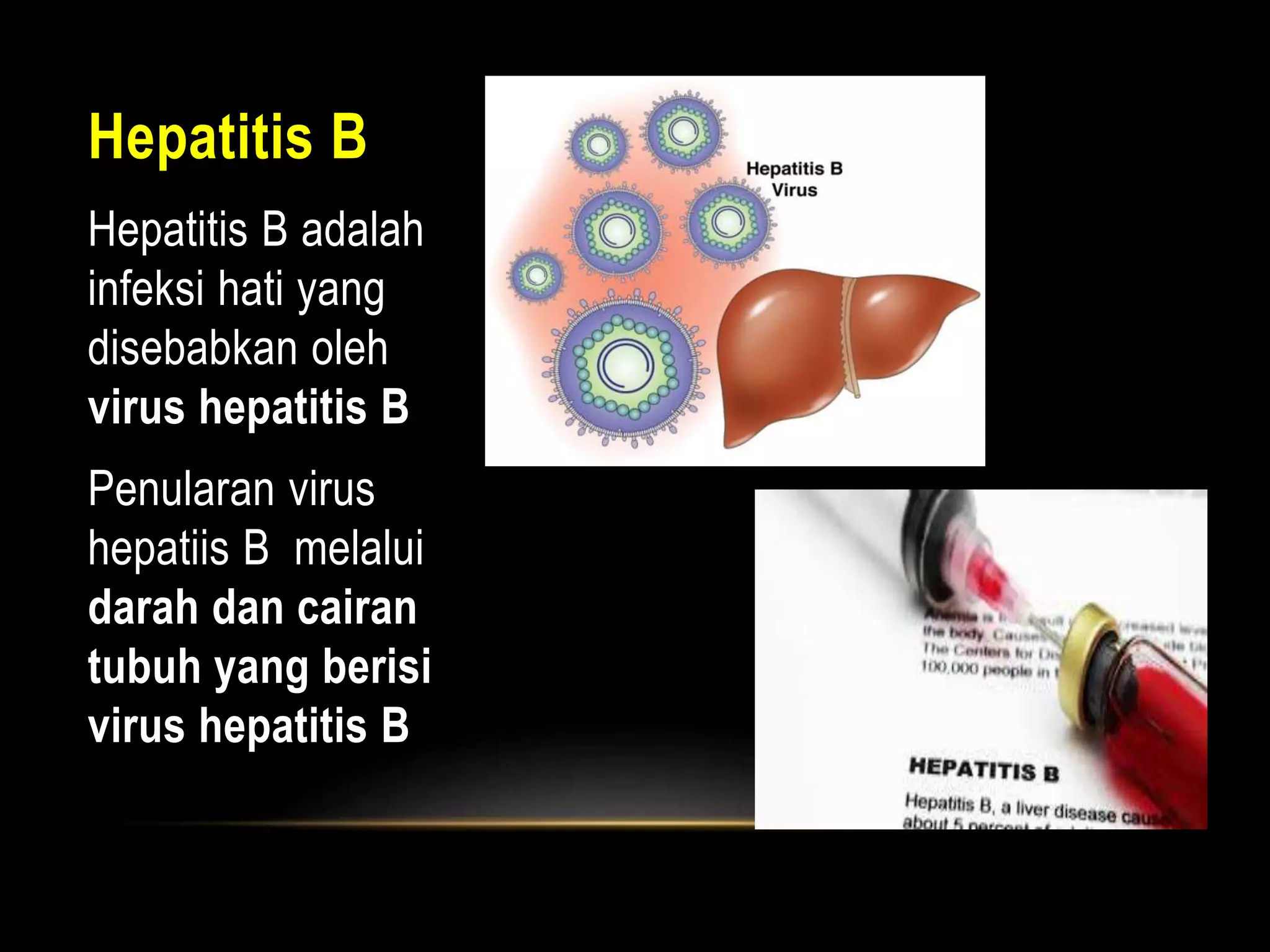 Hepatitis B
Hepatitis B adalah
infeksi hati yang
disebabkan oleh
virus hepatitis B
Penularan virus
hepatiis B melalui
darah dan cairan
tubuh yang berisi
virus hepatitis B
 